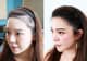Slider image (9) The Best Medical Hair Center by Dr. Orn 